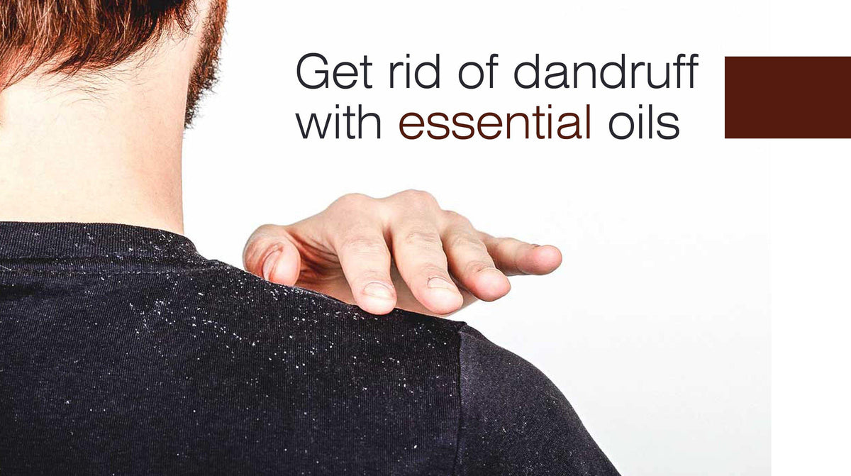 Get rid of dandruff in winter with essential oils - Keya Seth Aromatherapy