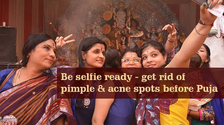 Say bye to pimples, acne & acne marks quickly before Puja - Keya Seth Aromatherapy