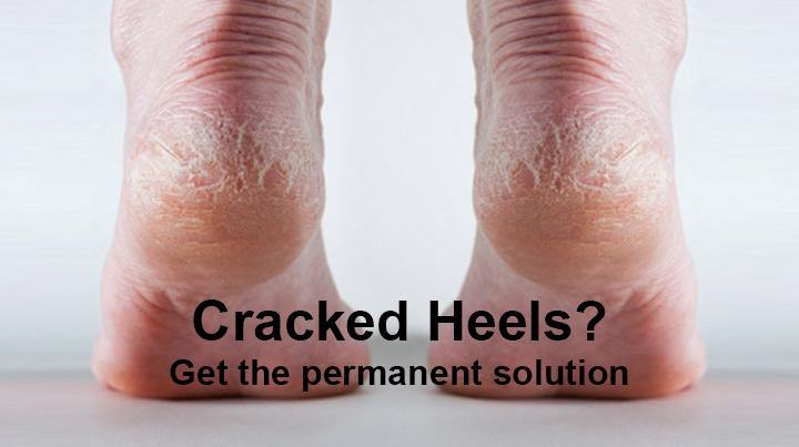 Blog 40: Suffering from Cracked Heels? Know the permanent solution - Keya Seth Aromatherapy