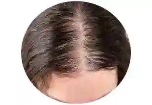 Hair thinning treatment products - Keya Seth Aromatherapy